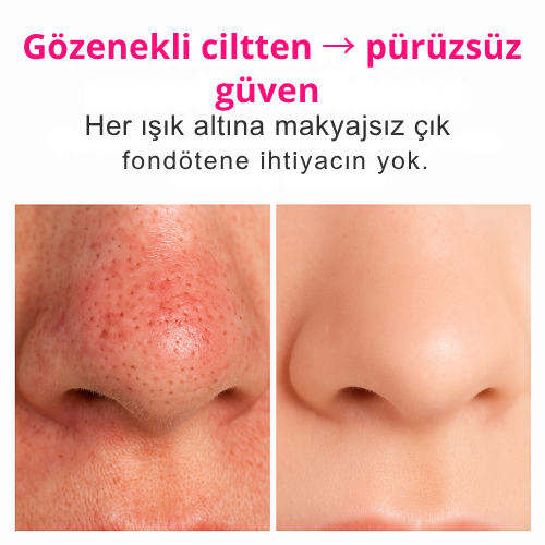 Pürtek™ Pro Mikro-Nabız Gözenek Temizleyici